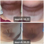 NeckLift™ – Transform Your Neck Today