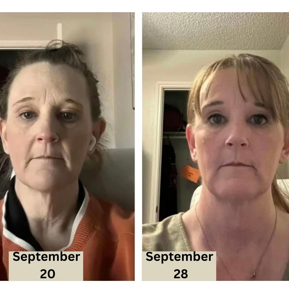 NeckLift™ – Transform Your Neck Today