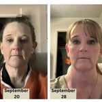 NeckLift™ – Transform Your Neck Today